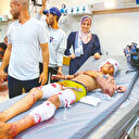 Türk doktorlar anlattı: Ameliyat ettiklerimizin yüzde 40’ı çocuktu