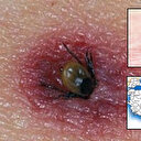 Her kene ölümcül virüs taşımıyor: İşte riskli iller...