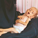 66 çocuk açlıktan öldü