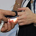 Uzmanından güneş yanığı uyarısı: Yıllar sonra da deri kanserine neden olabiliyor