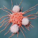 Yanlış pişirilen et kansere davetiye çıkarabilir