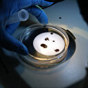 Türkiye'de yeni bir kene türü keşfedildi: 30'dan fazla hastalık taşıyabiliyor