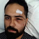 15 Temmuz'da Genelkurmay Başkanlığı önünde vurulan gazi Akkoç: "Darbeci asker dalga geçer bir ses tonu ile ‘sen kelime-i şehadet getir' dedi"