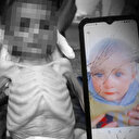 Bir bebek daha açlıktan hayatını kaybetti