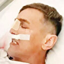 Aynı hastanede estetikten ikinci ölüm