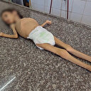 Gazze'de yetersiz beslenme nedeniyle 4 yaşındaki Rezan yaşamını yitirdi