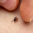 Uzman isim uyardı: Kenede erken ve doğru müdahale, bulaş riskini azaltıyor