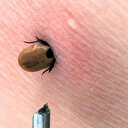 Kene bir kentte daha can aldı: Ölü sayısı artıyor