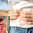 Mide sağlığınızı ertelemeyin