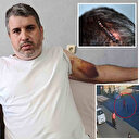 Miras anlaşmazlığında yeğenini beyzbol sopasıyla darp etmişti: İfadesi şaşırttı