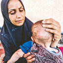 Açlıktan bebeklerin derisi çürüyor