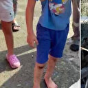 Başıboş köpekler sokakta dehşet saçtı: 6 yaşındaki çocuk sokak köpeklerinin saldırısına uğradı