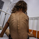 Filistinli 13 yaşındaki çocuk İsrail ablukası nedeniyle açlıktan öldü