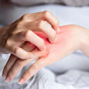 Sıcak ve nem mantar vakalarını artırıyor