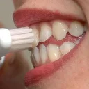 Ağız bakterileri kalp krizine yol açabilir