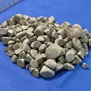 Vücudundan 287 tane taş çıkarıldı doktorlar bile şok oldu: 'Literatürde çok nadir görülen bir olay'