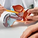 Ailede prostat kanseri olanlara meme kanserine karşı dikkatli olun uyarısı