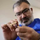 Özel kliniklerde 8 bin TL: Devlet hastanelerinde 188 TL’ye yapılmaya başlandı! Bakanlık onayı ile ilk kez Sivas’ta yapıldı