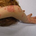 Kimse böyle olmak istemez