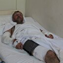 Ayı saldırısı bu hale getirdi