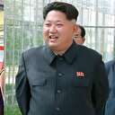 Kim'e benzemek için estetik oldu