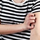 Sivrisineklerin sizi seçmesinin nedeni