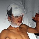 Samsun'da köpek dehşeti