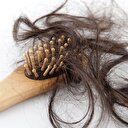 Kadınlarda saç dökülmesine dikkat