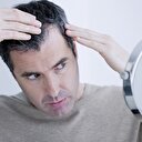 Saçı dökülenler dikkat: Nedeni bunlar olabilir