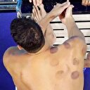 Hacamatlı şampiyon: Michael Phelps