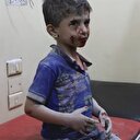 Suriyeli çocuğun insanlığı utandıran görüntüsü