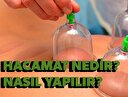 Hacamat nedir? Hacamat nasıl yapılır?
