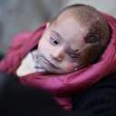 Dünyadan 'Kerim' bebeğe destek