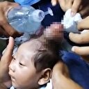 Filipinler'de boynuzlu bebek doğdu
