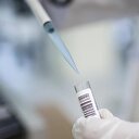 Alzaymırı önleyebilecek yeni hücre keşfedildi