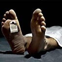 Öldükten 18 saat sonra kalbi çalıştı