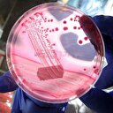 Kanserden korunmanın yolları