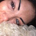 Göz rengini değiştirmek isterken kör oldu