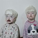 Albinizm hastası kardeşler duymuyor ve konuşmuyorlar