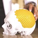3D Yazıcıyla kafatası üretildi