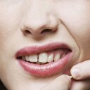 Sivilce nasıl geçer? Doğal yöntemlerle sivilceden kurtulma