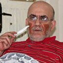 Yüzünde aniden çıkan yaralar hayatını kararttı