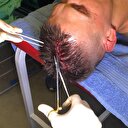 Skrtel'den büyük fedakarlık