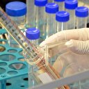 Bağımlılık zehrine yerli antikor