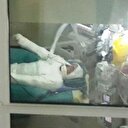 Vücudunun yüzde 55'i yanan adam taburcu oldu