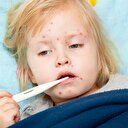 Kızamık salgını kapıda