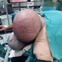 4 kiloluk kitleyi boynunda 50 yıl taşıdı