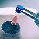 Oruç tutmak kök hücreleri yeniliyor