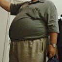 Bel bölgesindeki yağlanma D vitamini eksikliğinin habercisi