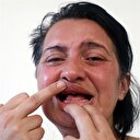 Beyaz diş istedi 32 dişinden oldu
